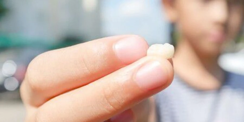  A close-up image of a person holding a tooth that has fallen out in their hand.