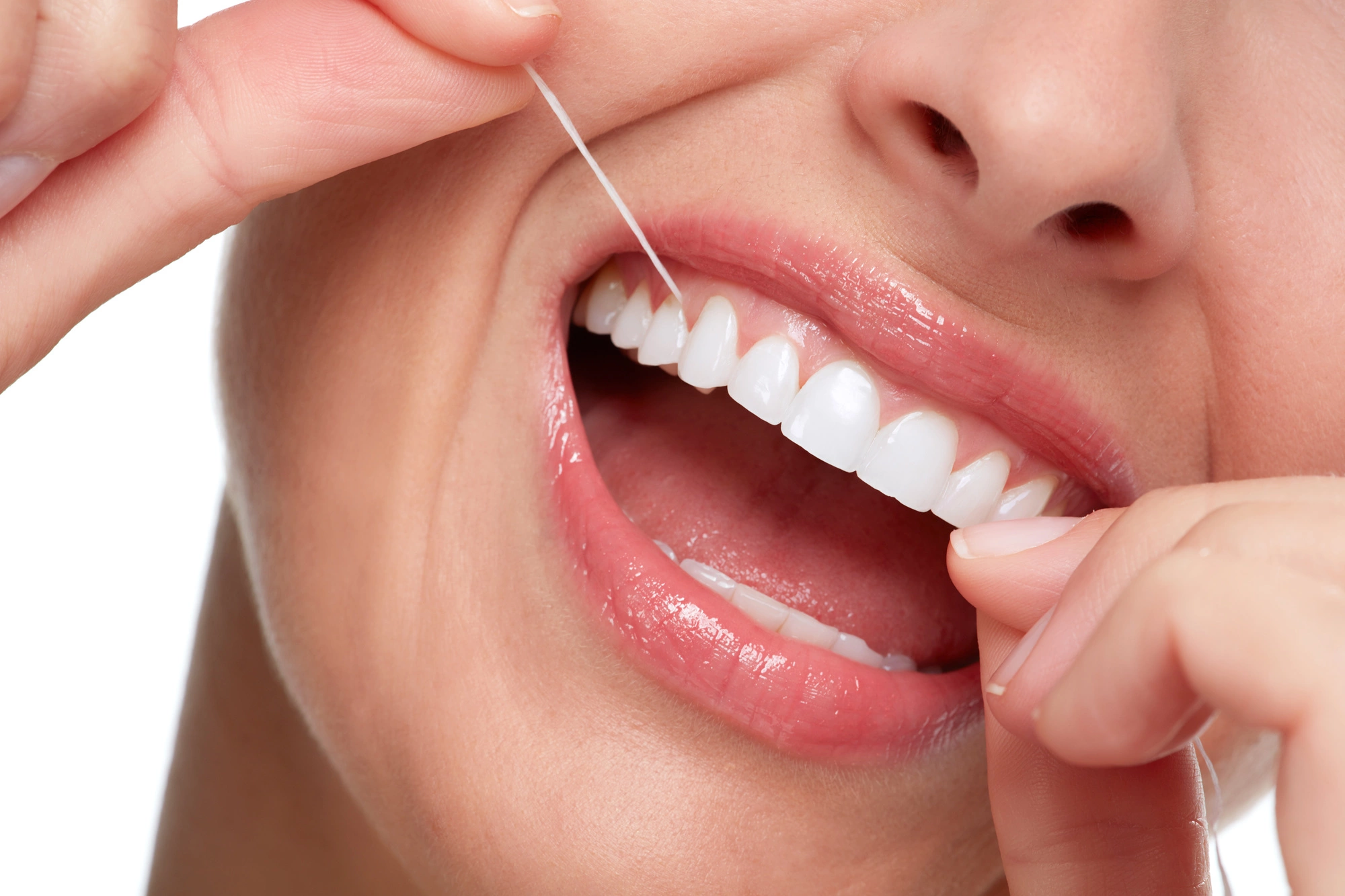 . Cara merapikan gigi tonggos secara alami: Menggunakan benang gigi