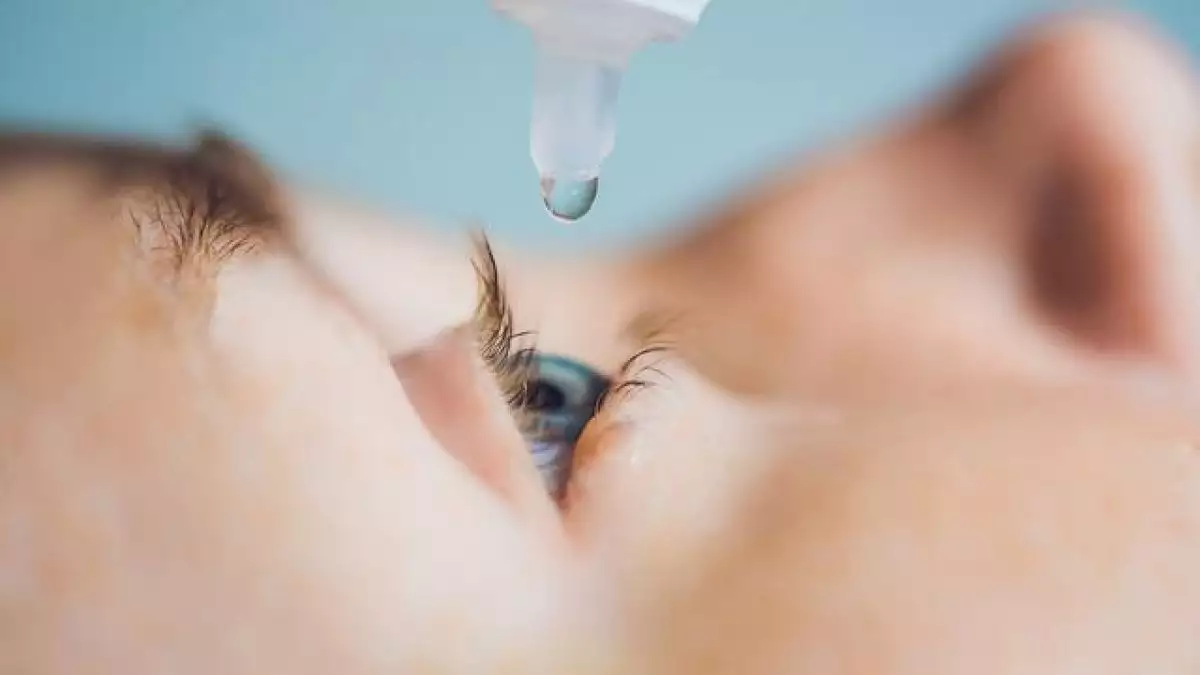 Cara mengobati mata bintitan: Penggunaan obat tetes mata antibiotik