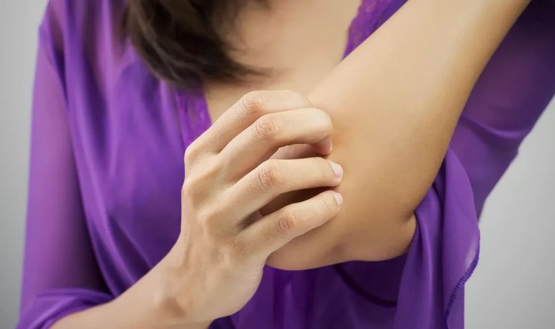 cara menghilangkan gatal pada kulit yang tak kunjung sembuh