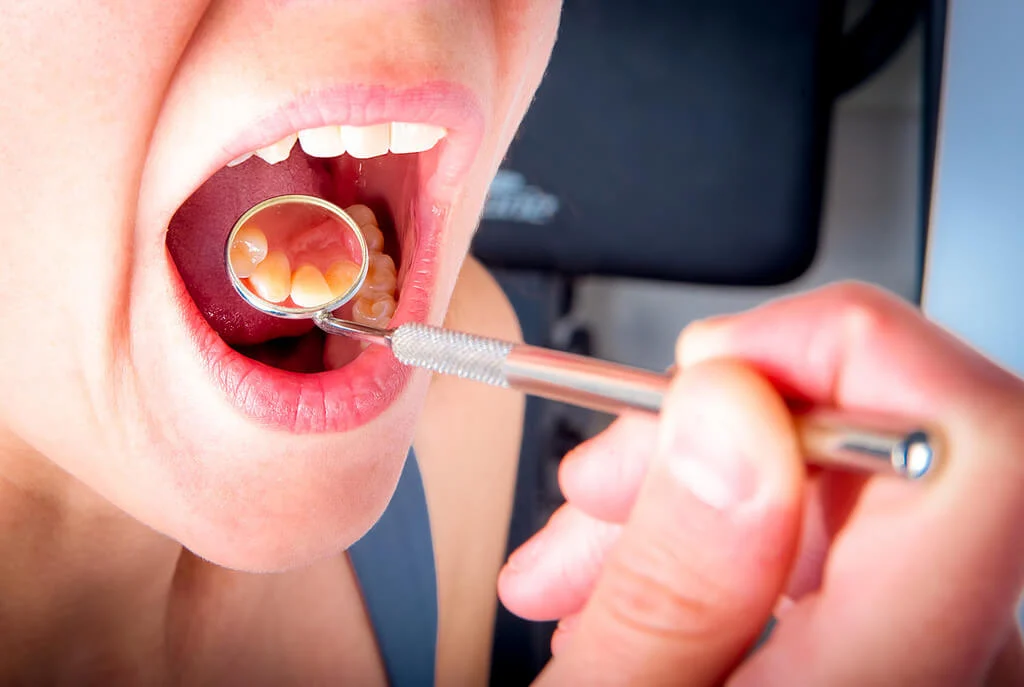 cara mencabut gigi sendiri